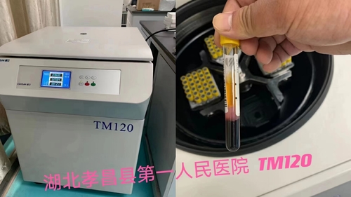 Latest company news about PRPのcentrigue