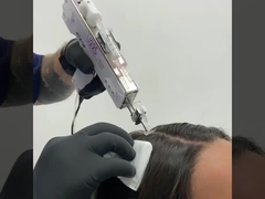 U225 ポータブル メソメソセラピー 銃 スキンセラピー 美容器 顔ケア まだレビューはありません